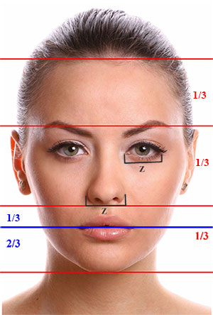 rinoplastia frontal