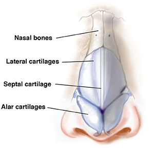 rinoplastia